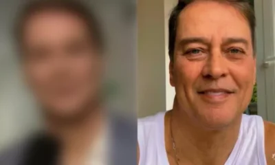 Marcello Antony faz harmonizacao facial resultado impressiona