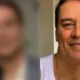 Marcello Antony faz harmonizacao facial resultado impressiona