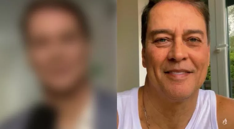 Marcello Antony faz harmonizacao facial resultado impressiona