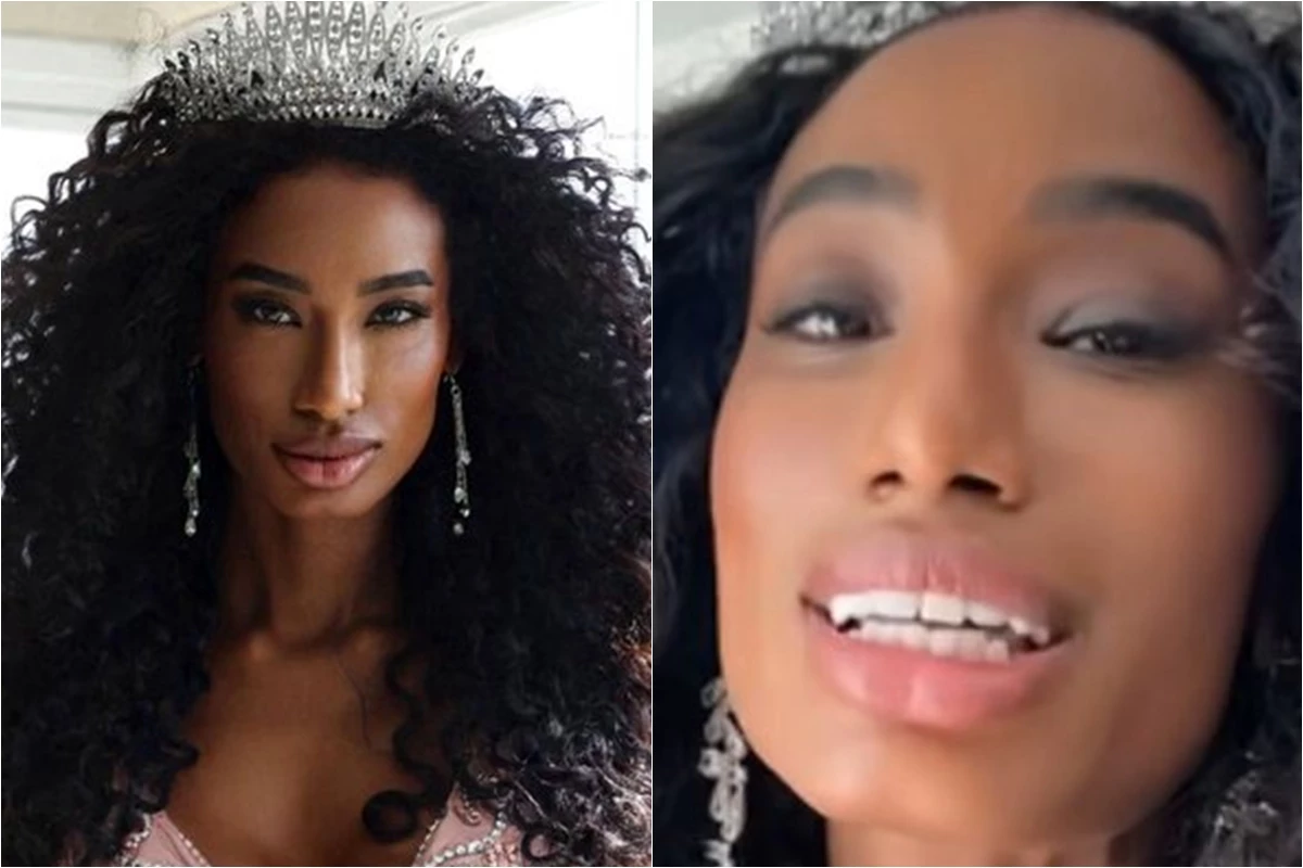 Miss São Paulo, Milla Vieira é atacada por causa da aparência e comunicado é feito 31 Miss Sao Paulo Milla Vieira e atacada por causa da