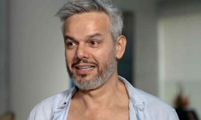 Otaviano Costa choca as redes sociais ao revelar cicatriz apos