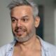 Otaviano Costa choca as redes sociais ao revelar cicatriz apos