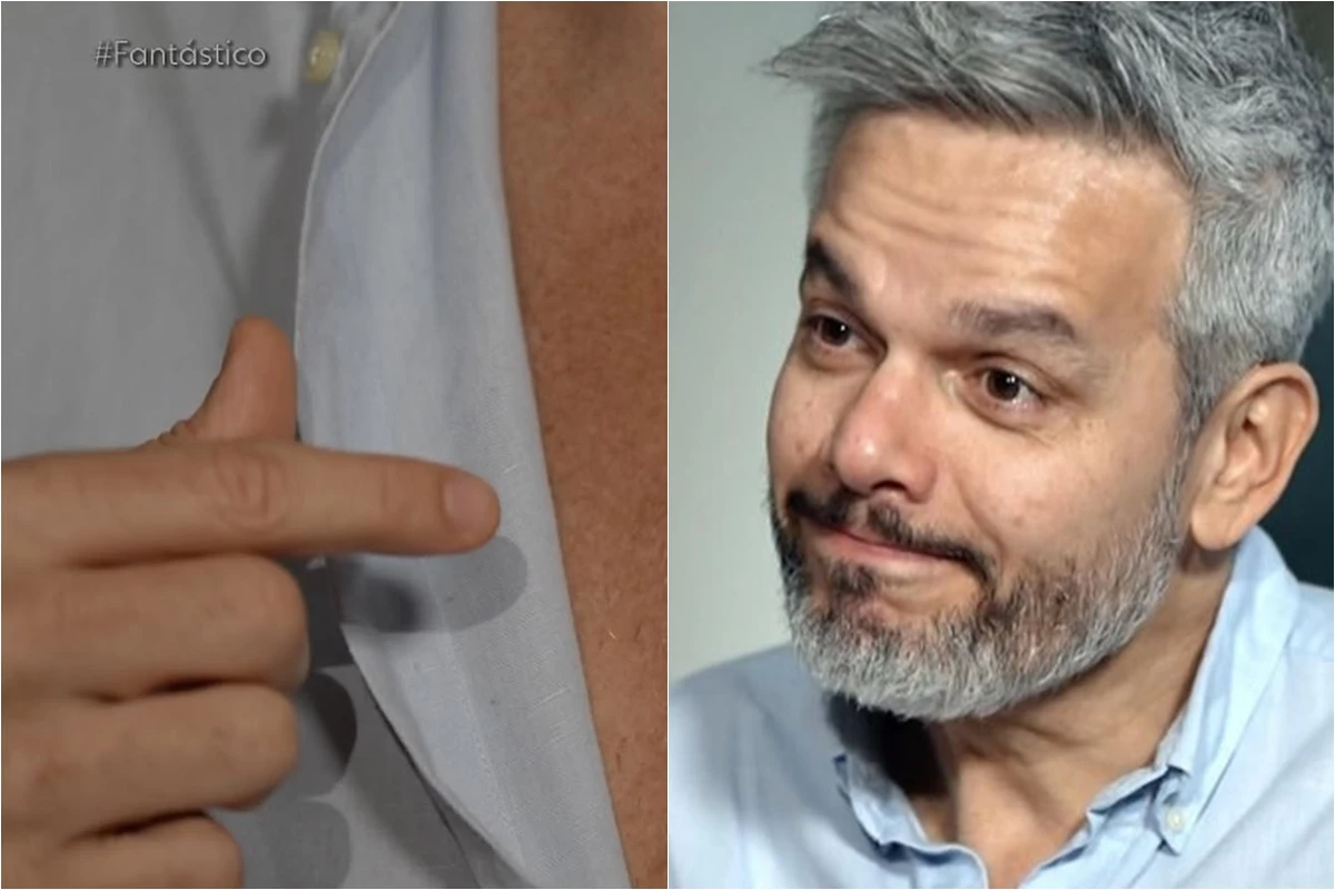 Otaviano Costa dá a primeira entrevista após cirurgia no coração e mostra cicatriz no peito 33 Otaviano Costa da a primeira entrevista apos cirurgia no coracao