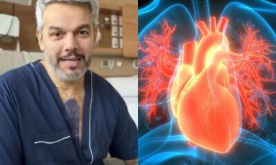 Otaviano Costa revela defeito cardiaco congenito que causou aneurisma e