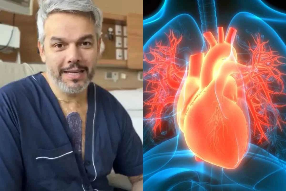 Otaviano Costa revela defeito cardiaco congenito que causou aneurisma e