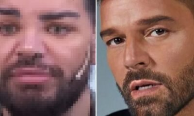 Quem e o homem que ficou irreconhecivel apos realizar mais