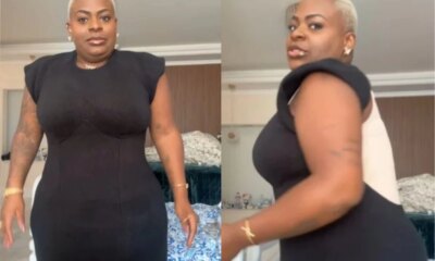 ‘Toda enfaixada Jojo Todynho passa por nova cirurgia e medico