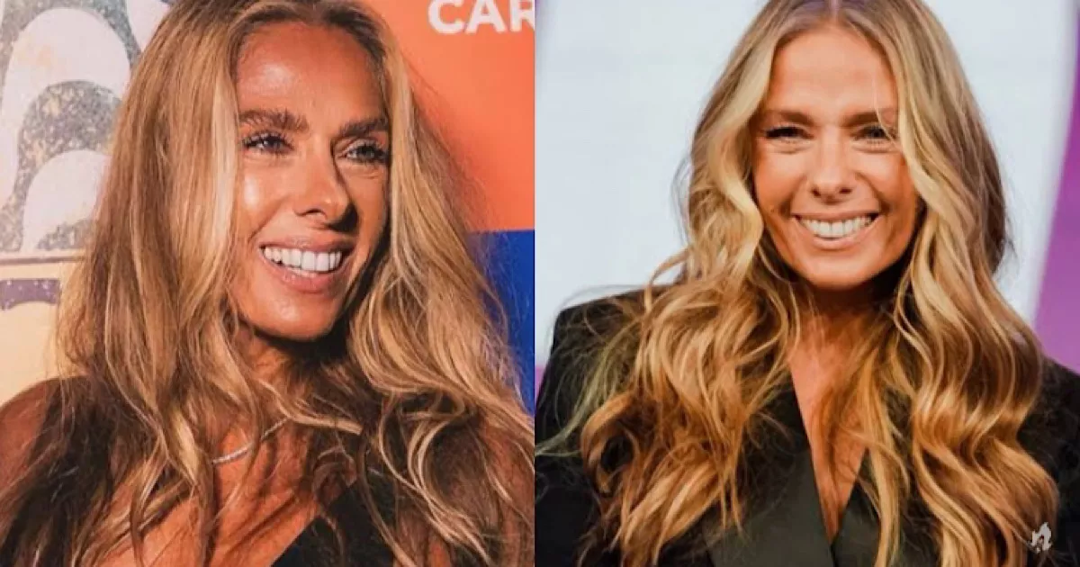 Conheca a doenca degenerativa que pode deixar Adriane Galisteu