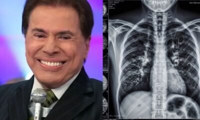 Hospital acaba de confirmar causa da morte de Silvio Santos