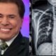 Hospital acaba de confirmar causa da morte de Silvio Santos
