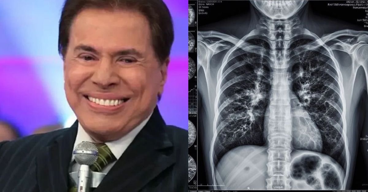 Hospital acaba de confirmar causa da morte de Silvio Santos