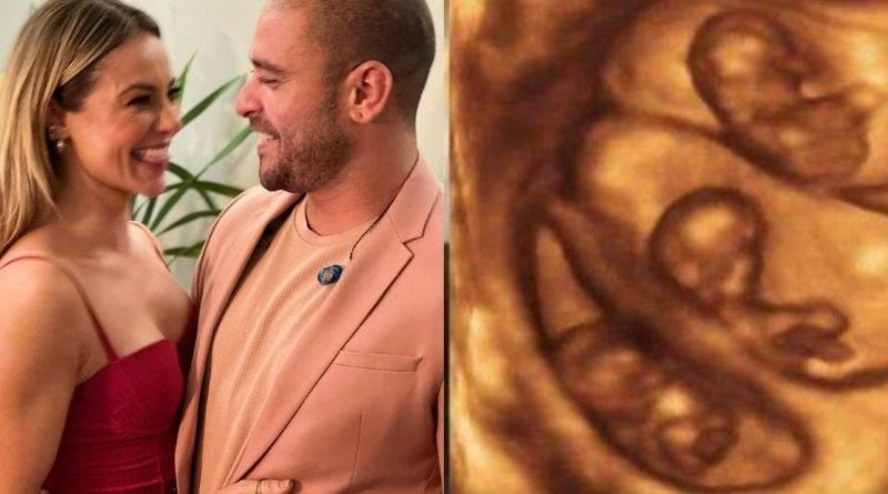 Aos 41 anos, Paolla Oliveira realiza sonho do Pai, e anuncia vou ter Trigêmeos. 31 IMG 20240813 172435 297