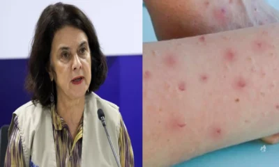 Ministra da Saude revela que Brasil esta no primeiro