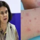 Ministra da Saude revela que Brasil esta no primeiro