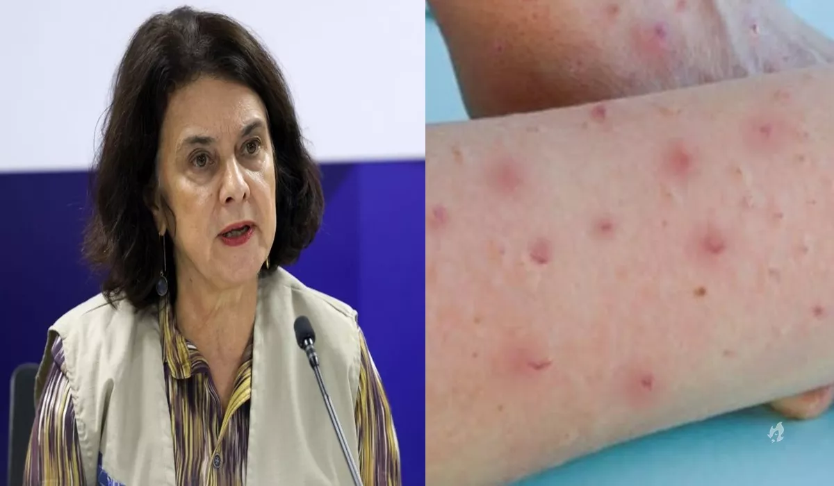 Ministra da Saude revela que Brasil esta no primeiro