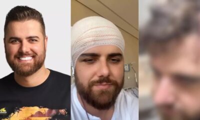 Cantor Ze Neto mostra corte gigantesco na cabeca e deixa