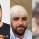 Cantor Ze Neto mostra corte gigantesco na cabeca e deixa