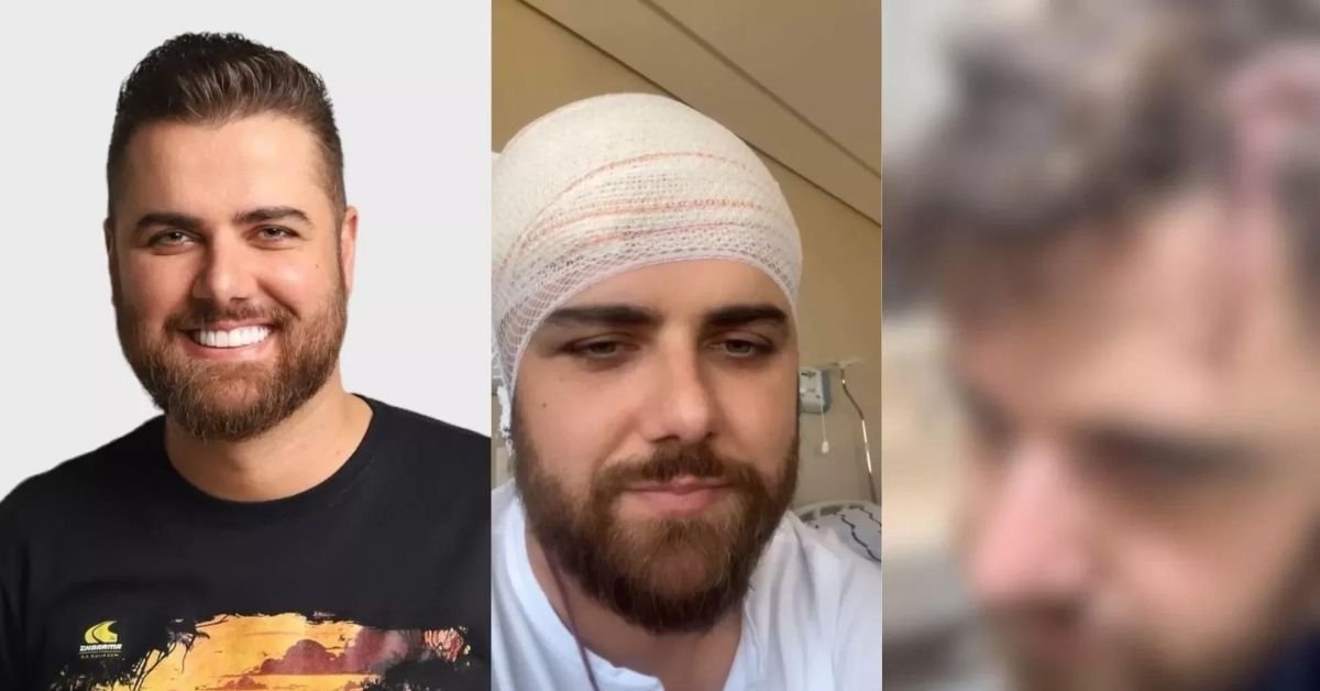 Cantor Ze Neto mostra corte gigantesco na cabeca e