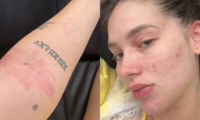 Equipe de Vieginia Fosceca esclarece diagnostico da apresentadora apos duas