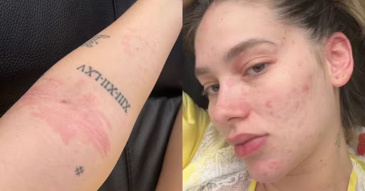 Equipe de Vieginia Fosceca esclarece diagnostico da apresentadora apos duas