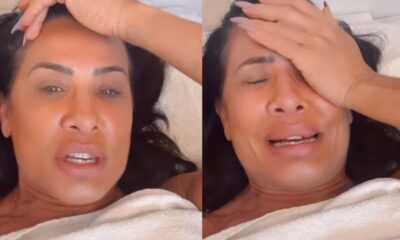 Especialista explica que pode acontecer com rosto Scheila Carvalho apos