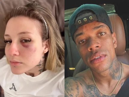 Ex-esposa de jogador do Palmeiras expõe hematomas e relata agressão 31 Ex-esposa de jogador do Palmeiras expõe hematomas e relata agressão