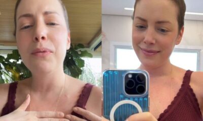 Fabiana Justus entrega novidade no tratamento de cancer Manutencao