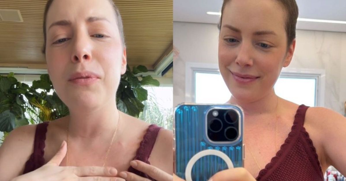 Fabiana Justus entrega novidade no tratamento de cancer Manutencao
