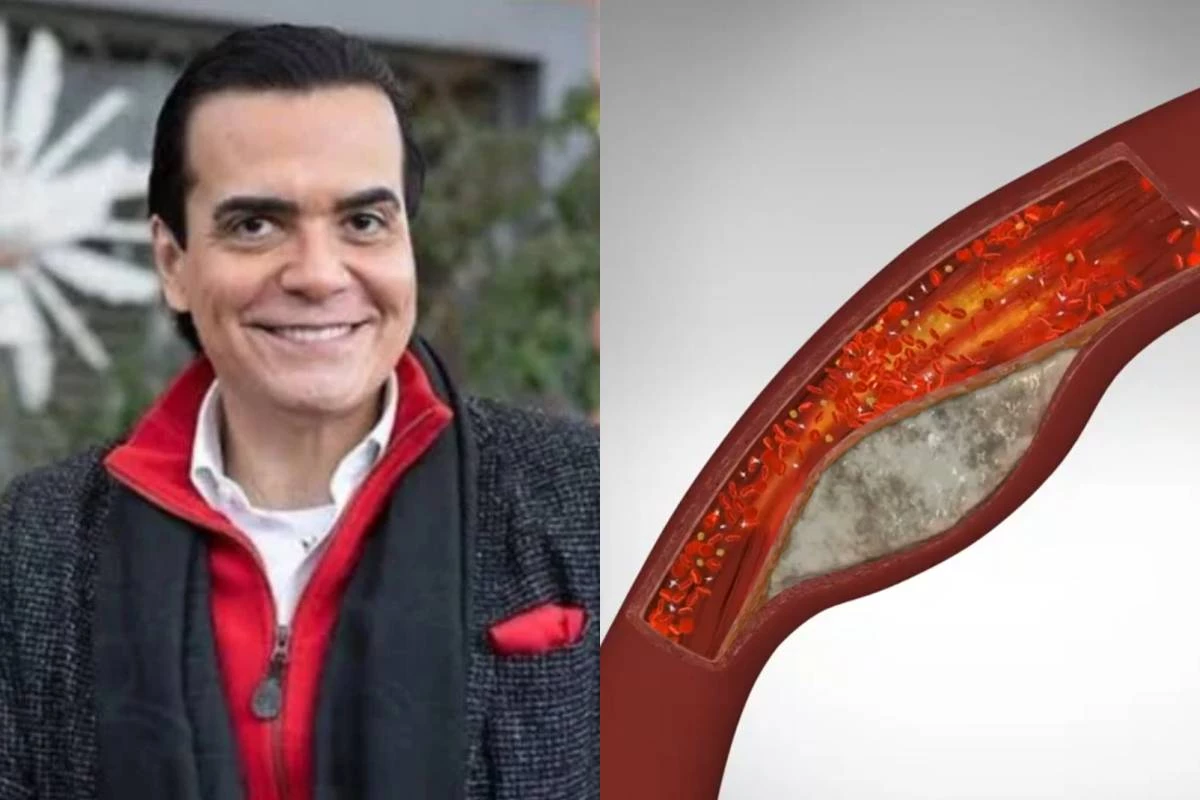 Fábio Arruda tinha 90% de artéria obstruída antes de perder a vida, e havia passado por uma angioplastia 31 Fabio Arruda tinha 90 de arteria obstruida antes de perder
