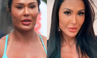 Gracyanne Barbosa remove preenchimentos do rosto: “Equilíbrio”