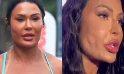 Gracyanne Barbosa reverte procedimentos esteticos no rosto e mostra resultado