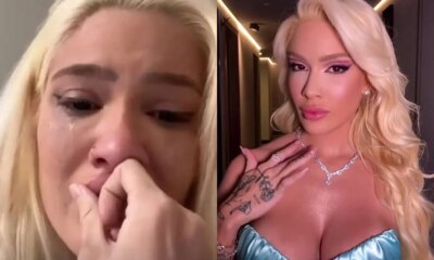 Karoline Lima e vitima de acidente e sofre queimaduras de