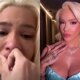 Karoline Lima e vitima de acidente e sofre queimaduras de
