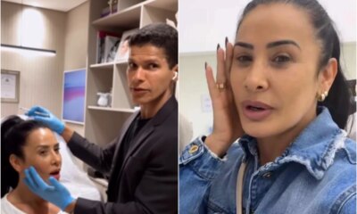 Scheila Carvalho faz reversao de procedimento estetico e mostra o