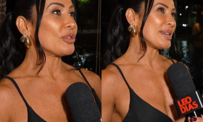 Scheila fala sobre a reversão da harmonização facial: “Meu rosto inchava”