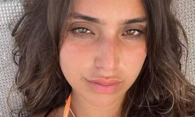Vanessa Lopes passa por procedimentos esteticos no rosto e comenta
