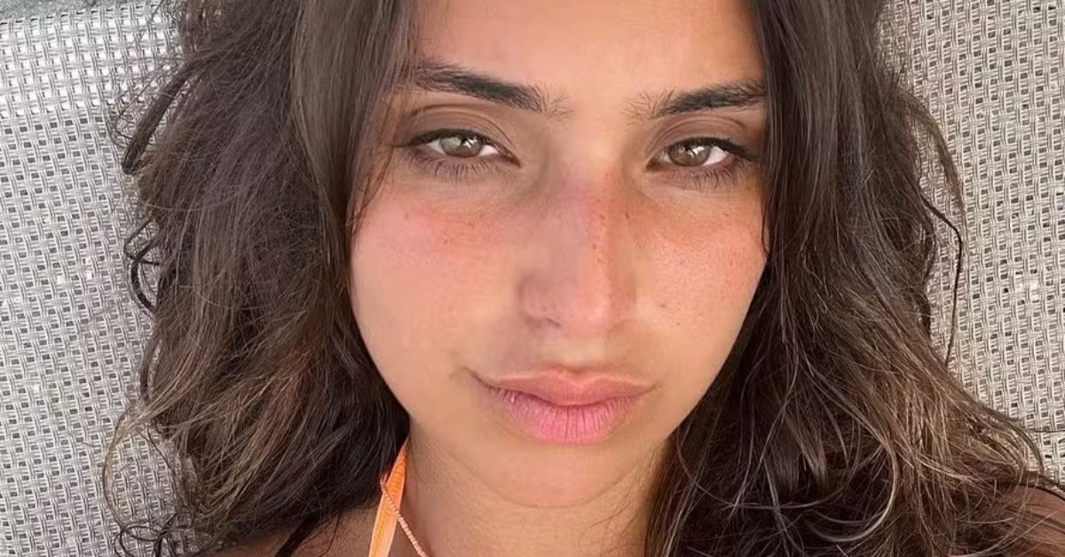 Vanessa Lopes passa por procedimentos esteticos no rosto e comenta