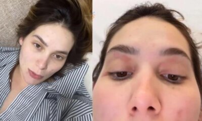 Virginia Fonseca enfrenta reacao alergica e virose apos o nascimento