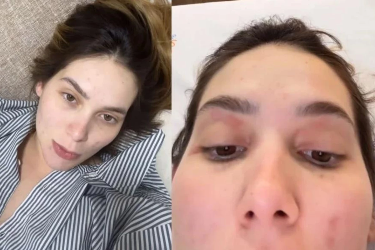 Virginia Fonseca enfrenta reação alérgica e virose após o nascimento do filho:’Que bicheira é essa?’ 31 Virginia Fonseca enfrenta reacao alergica e virose apos o nascimento
