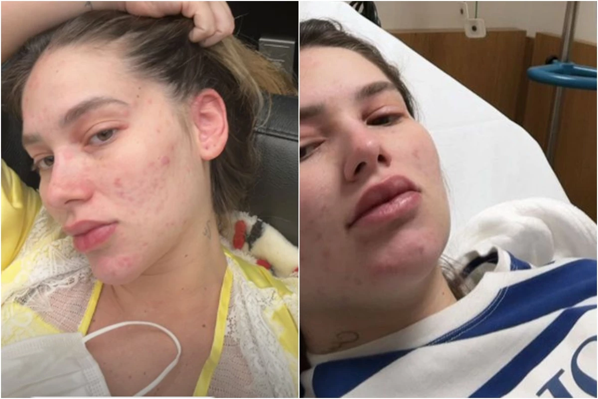 Virginia Fonseca recebe alta, mas precisa voltar às pressas ao hospital: ‘continuo inchando muito’ 31 Virginia Fonseca recebe alta mas precisa voltar as pressas ao