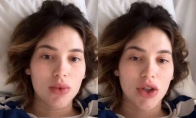 Virginia recebe alta após passar a noite no hospital por reação alérgica