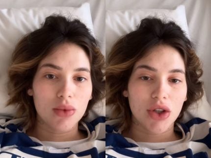 Virginia recebe alta após passar a noite no hospital por reação alérgica 31 Virginia recebe alta após passar a noite no hospital por reação alérgica