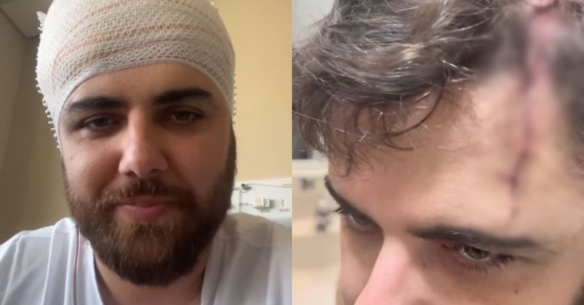 Zé Neto levou mais de 50 pontos na cabeça 31 Ze Neto levou mais de 50 pontos na cabeca