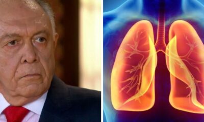 sintomas causas e tratamento da doenca que tirou a vida