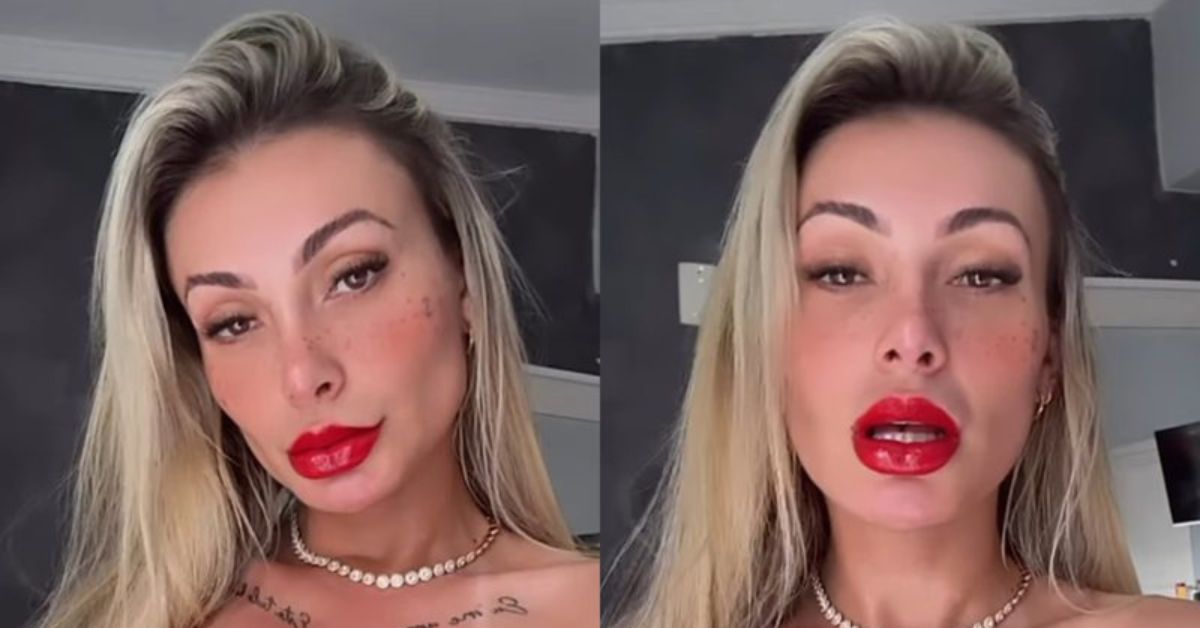 Andressa Urach assusta com novo procedimento inacreditável e fãs reagem: ‘Psiquiatra’ 31 Andressa Urach assusta com novo procedimento inacreditavel e fas reagem
