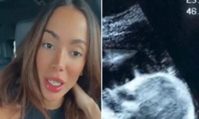 Anitta pega todo mundo de surpresa ao mostrar ultrassom e