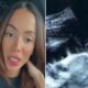 Anitta pega todo mundo de surpresa ao mostrar ultrassom e