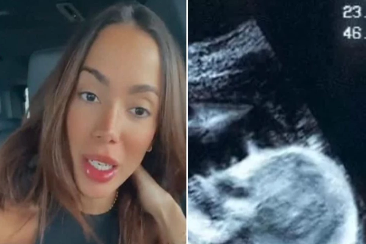 Anitta pega todo mundo de surpresa ao mostrar ultrassom e