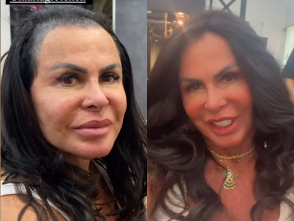 Após perder cabelo, Gretchen troca a prótese capilar. Veja antes e depois! 31 Após perder cabelo, Gretchen troca a prótese capilar. Veja antes e depois!