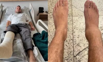 As vesperas do casamento Lucas Rangel fratura a perna em